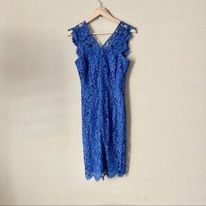 Set Scalloped Lace Dress